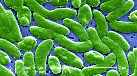 Vibrio vulnificus